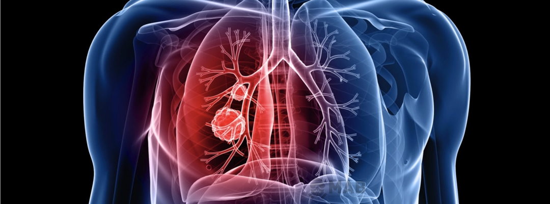 MAB Yıkım, Asbest Söküm, Asbestli İnşaat, Yapı ve Bina Söküm Hizmetleri Gerçekleştiren Profesyonel Bir Asbest Söküm Firmasıdır.